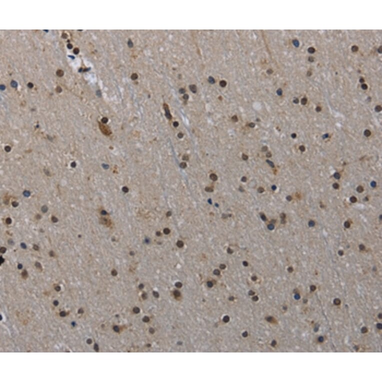 Immunohistochemistry - MVD Antibody from Signalway Antibody (37745) - Antibodies.com