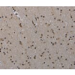 Immunohistochemistry - MVD Antibody from Signalway Antibody (37745) - Antibodies.com