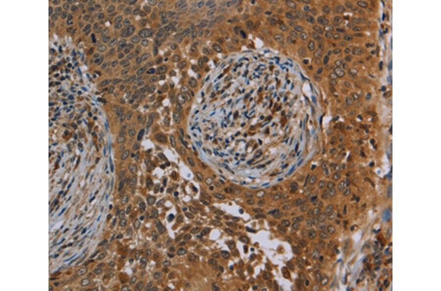 Immunohistochemistry - OSM Antibody from Signalway Antibody (37783) - Antibodies.com