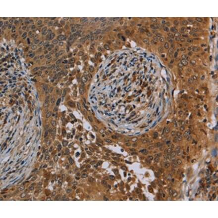 Immunohistochemistry - OSM Antibody from Signalway Antibody (37783) - Antibodies.com