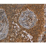 Immunohistochemistry - OSM Antibody from Signalway Antibody (37783) - Antibodies.com