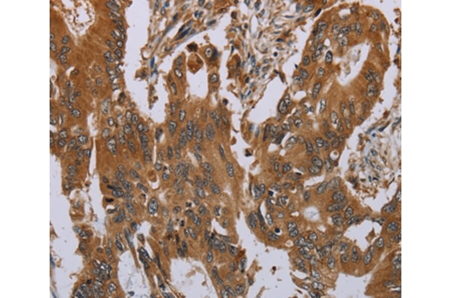 Immunohistochemistry - OSM Antibody from Signalway Antibody (37783) - Antibodies.com