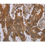 Immunohistochemistry - OSM Antibody from Signalway Antibody (37783) - Antibodies.com