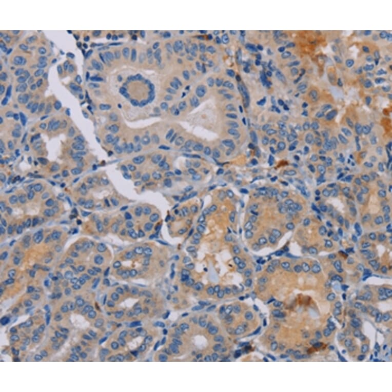 Immunohistochemistry - PYY Antibody from Signalway Antibody (37813) - Antibodies.com