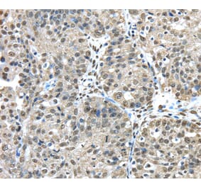 Immunohistochemistry - FUS Antibody from Signalway Antibody (40153) - Antibodies.com