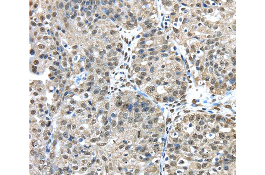 Immunohistochemistry - FUS Antibody from Signalway Antibody (40153) - Antibodies.com