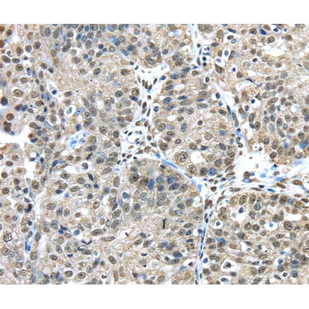 Immunohistochemistry - FUS Antibody from Signalway Antibody (40153) - Antibodies.com