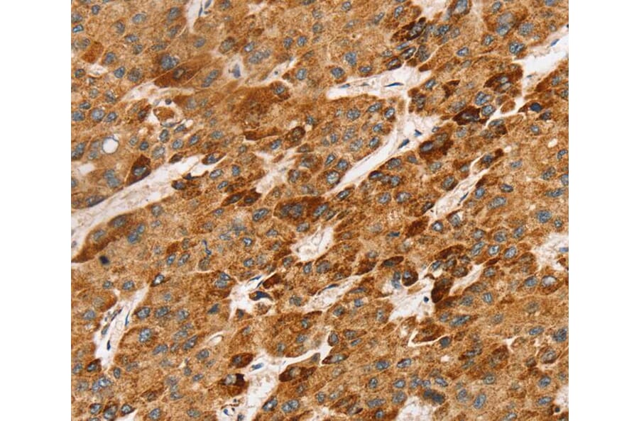 Immunohistochemistry - LTB Antibody from Signalway Antibody (40255) - Antibodies.com