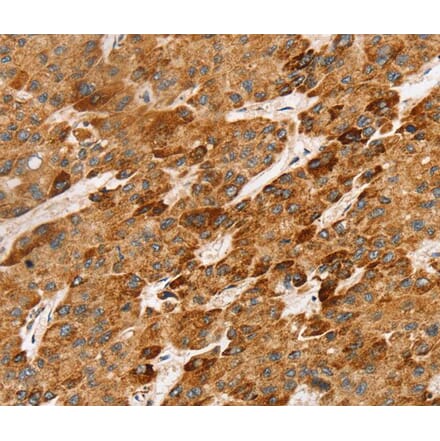 Immunohistochemistry - LTB Antibody from Signalway Antibody (40255) - Antibodies.com