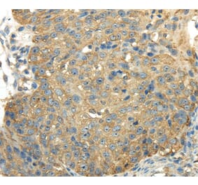 Immunohistochemistry - PKM Antibody from Signalway Antibody (40306) - Antibodies.com