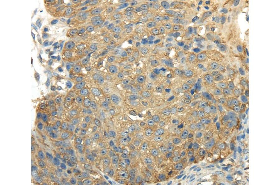 Immunohistochemistry - PKM Antibody from Signalway Antibody (40306) - Antibodies.com