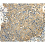 Immunohistochemistry - PKM Antibody from Signalway Antibody (40306) - Antibodies.com