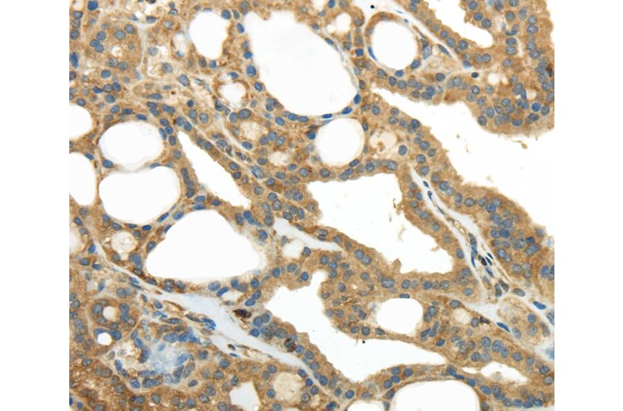Immunohistochemistry - PKM Antibody from Signalway Antibody (40306) - Antibodies.com
