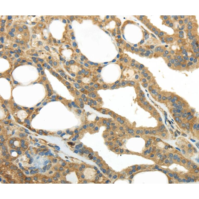 Immunohistochemistry - PKM Antibody from Signalway Antibody (40306) - Antibodies.com