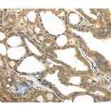 Immunohistochemistry - PKM Antibody from Signalway Antibody (40306) - Antibodies.com