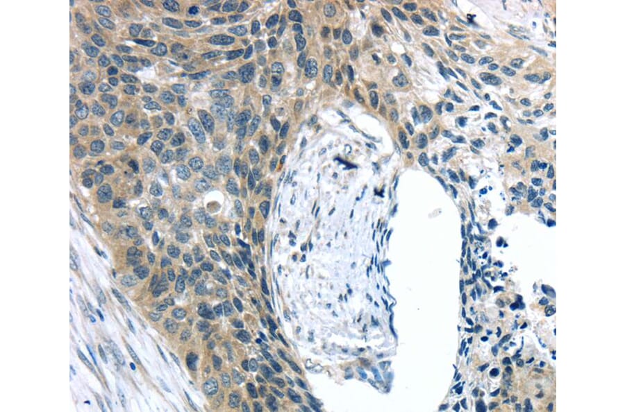 Immunohistochemistry - KIT Antibody from Signalway Antibody (40357) - Antibodies.com