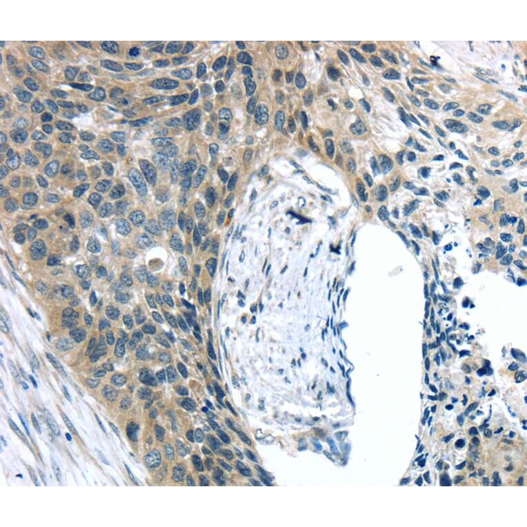 Immunohistochemistry - KIT Antibody from Signalway Antibody (40357) - Antibodies.com