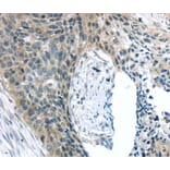 Immunohistochemistry - KIT Antibody from Signalway Antibody (40357) - Antibodies.com