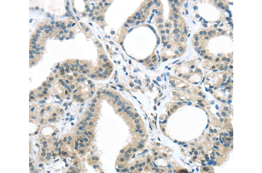 Immunohistochemistry - KIT Antibody from Signalway Antibody (40357) - Antibodies.com