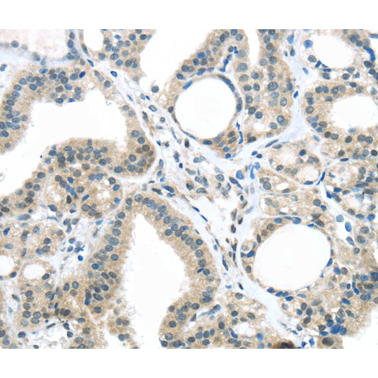 Immunohistochemistry - KIT Antibody from Signalway Antibody (40357) - Antibodies.com