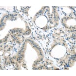 Immunohistochemistry - KIT Antibody from Signalway Antibody (40357) - Antibodies.com