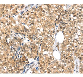Immunohistochemistry - TPR Antibody from Signalway Antibody (40365) - Antibodies.com