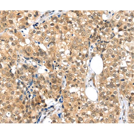 Immunohistochemistry - TPR Antibody from Signalway Antibody (40365) - Antibodies.com