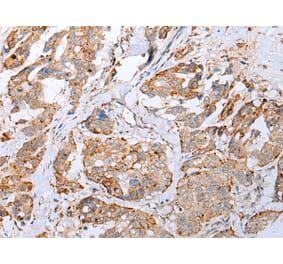 Immunohistochemistry - IL6 Antibody from Signalway Antibody (42709) - Antibodies.com