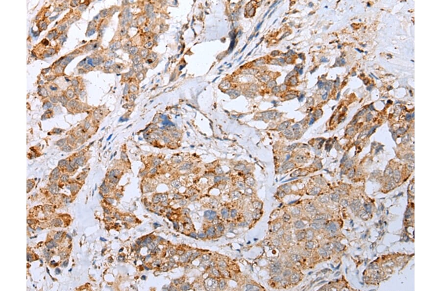 Immunohistochemistry - IL6 Antibody from Signalway Antibody (42709) - Antibodies.com