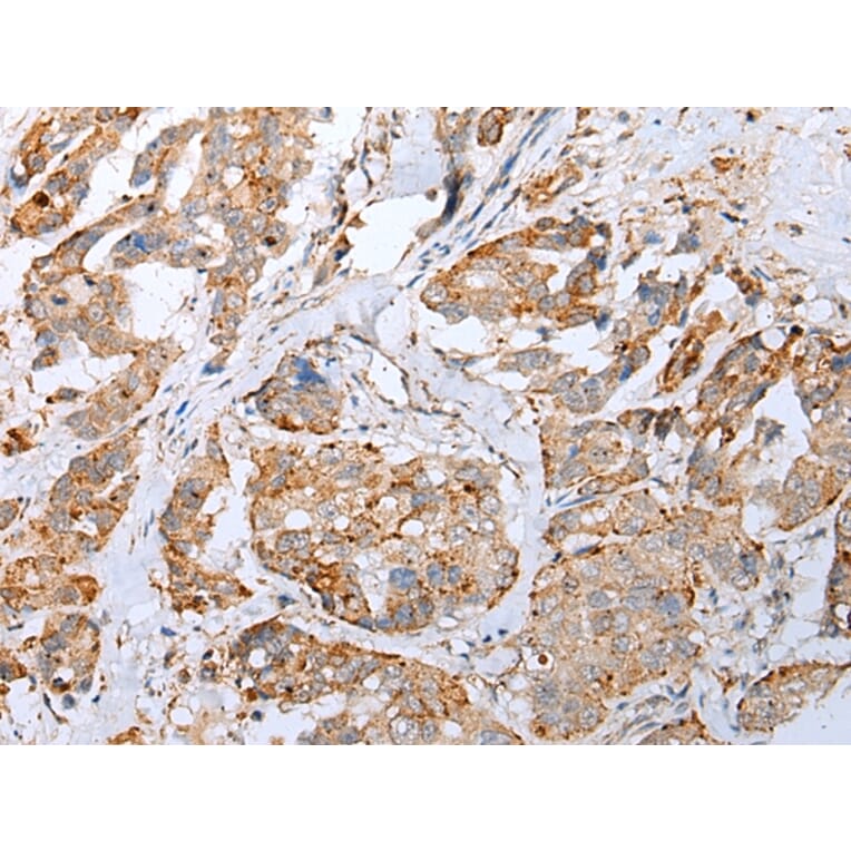 Immunohistochemistry - IL6 Antibody from Signalway Antibody (42709) - Antibodies.com