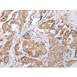 Immunohistochemistry - IL6 Antibody from Signalway Antibody (42709) - Antibodies.com