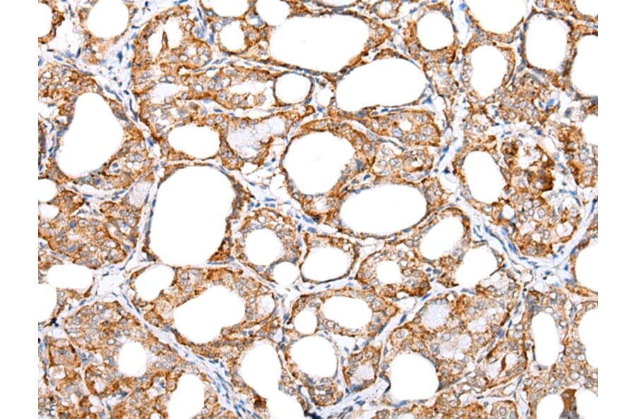 Immunohistochemistry - IL6 Antibody from Signalway Antibody (42709) - Antibodies.com