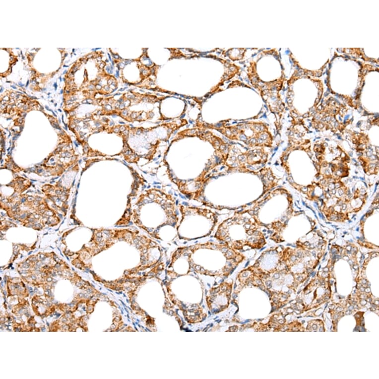 Immunohistochemistry - IL6 Antibody from Signalway Antibody (42709) - Antibodies.com