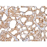 Immunohistochemistry - IL6 Antibody from Signalway Antibody (42709) - Antibodies.com