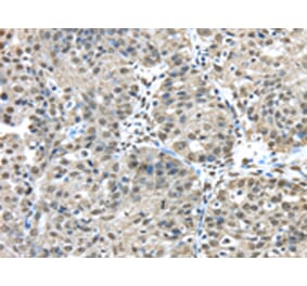 Immunohistochemistry - FUS Antibody from Signalway Antibody (42783) - Antibodies.com