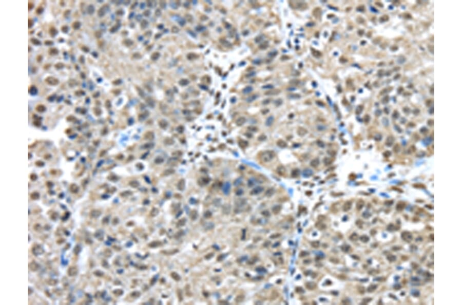 Immunohistochemistry - FUS Antibody from Signalway Antibody (42783) - Antibodies.com
