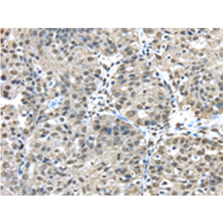 Immunohistochemistry - FUS Antibody from Signalway Antibody (42783) - Antibodies.com