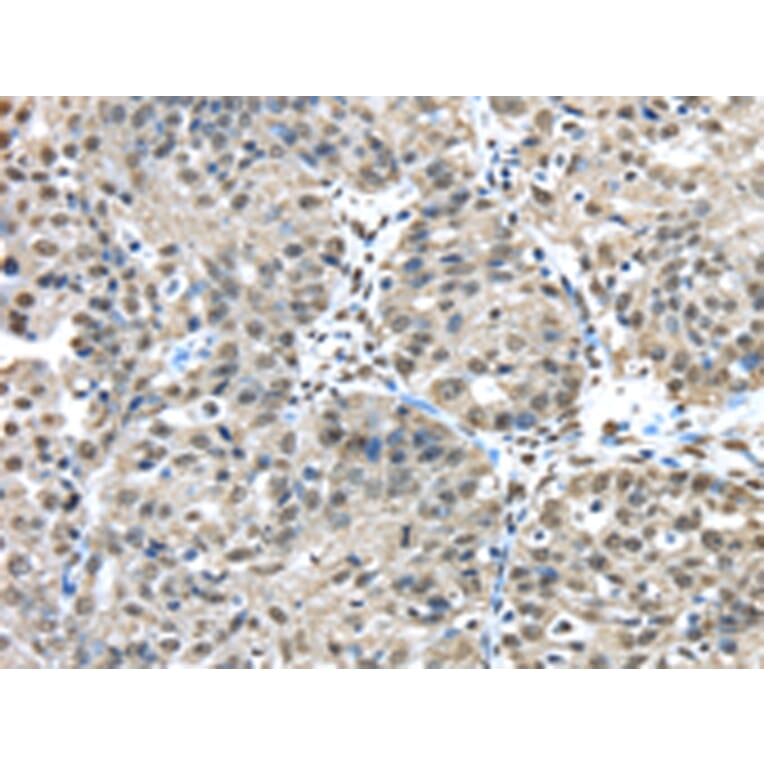 Immunohistochemistry - FUS Antibody from Signalway Antibody (42783) - Antibodies.com