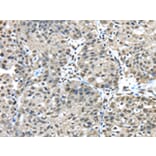 Immunohistochemistry - FUS Antibody from Signalway Antibody (42783) - Antibodies.com