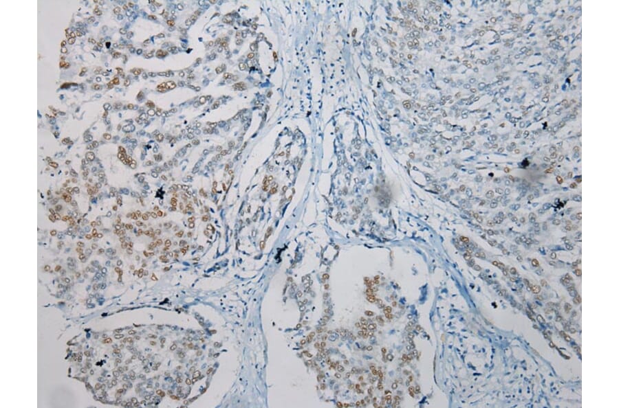 Immunohistochemistry - TKT Antibody from Signalway Antibody (42786) - Antibodies.com