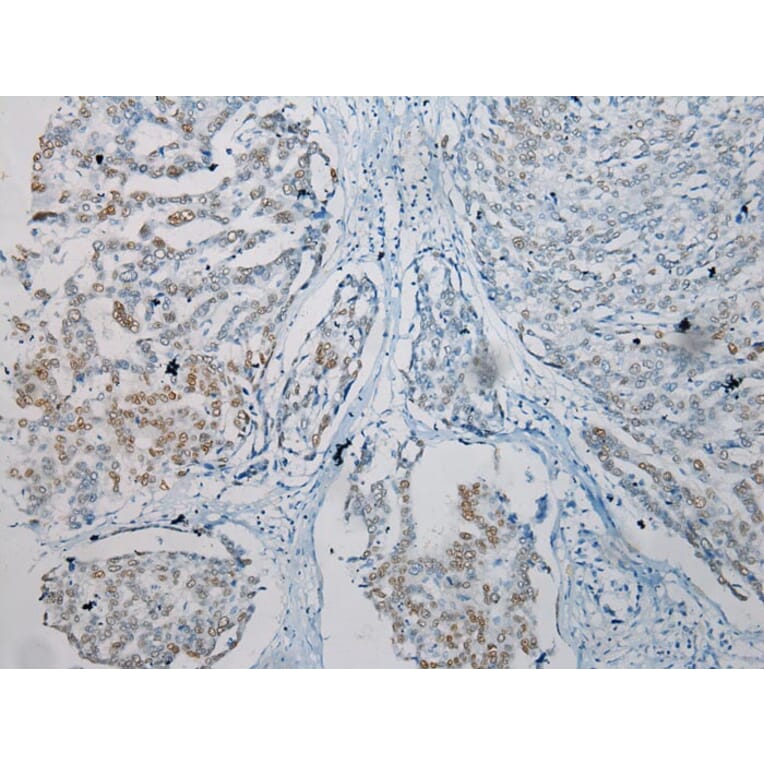 Immunohistochemistry - TKT Antibody from Signalway Antibody (42786) - Antibodies.com