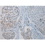 Immunohistochemistry - TKT Antibody from Signalway Antibody (42786) - Antibodies.com