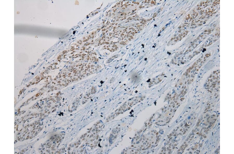 Immunohistochemistry - TKT Antibody from Signalway Antibody (42786) - Antibodies.com