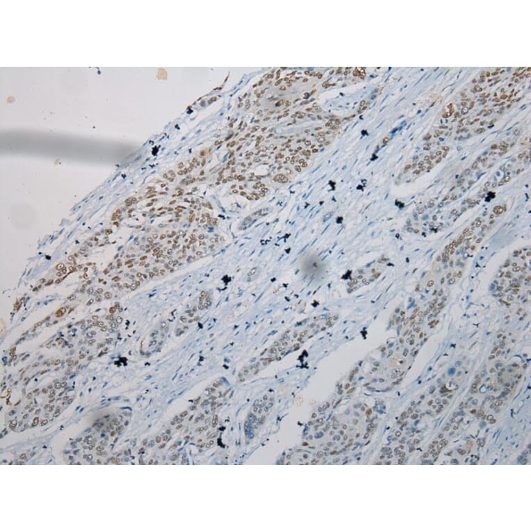 Immunohistochemistry - TKT Antibody from Signalway Antibody (42786) - Antibodies.com