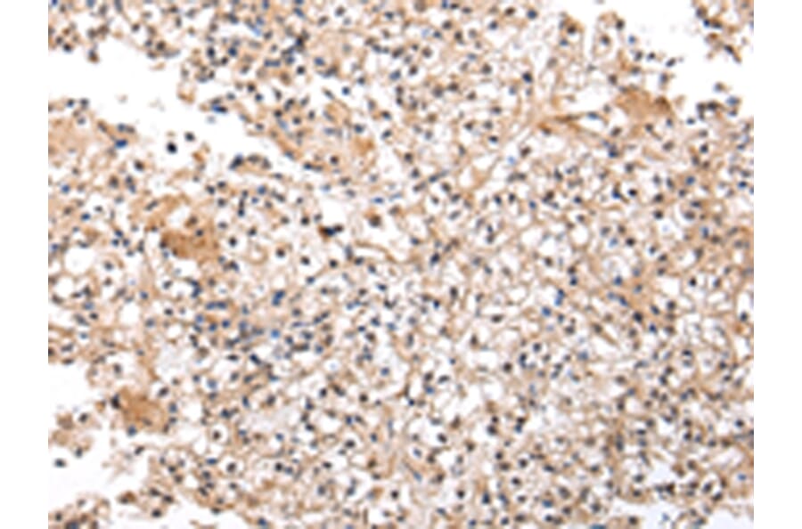 Immunohistochemistry - UXT Antibody from Signalway Antibody (42823) - Antibodies.com