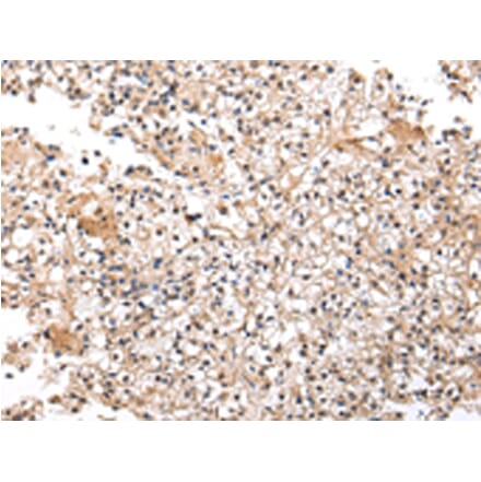 Immunohistochemistry - UXT Antibody from Signalway Antibody (42823) - Antibodies.com