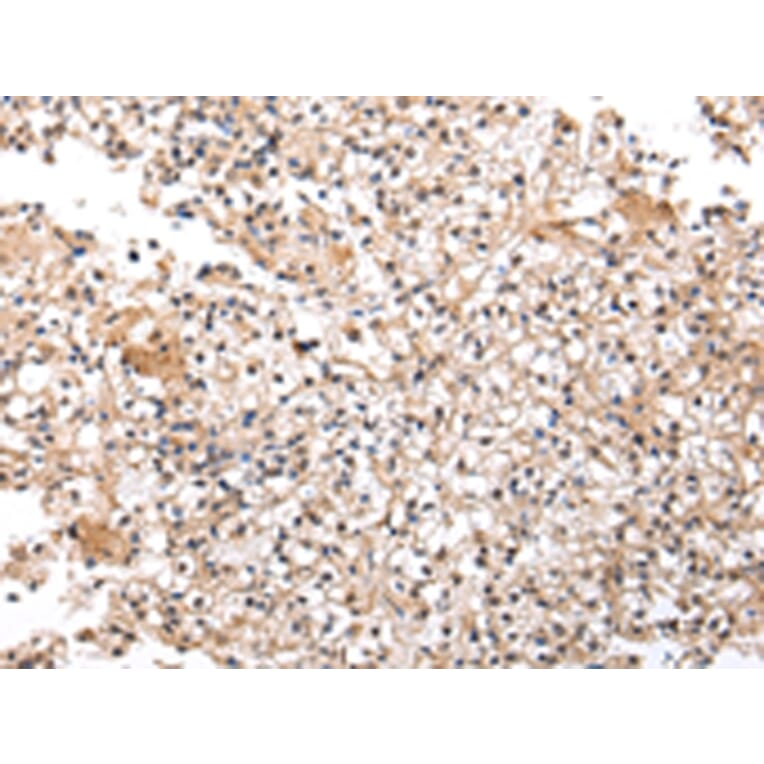 Immunohistochemistry - UXT Antibody from Signalway Antibody (42823) - Antibodies.com