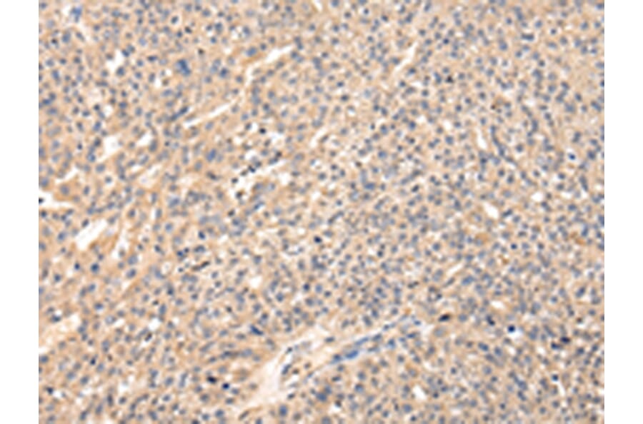 Immunohistochemistry - VIP Antibody from Signalway Antibody (42832) - Antibodies.com