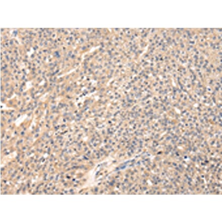 Immunohistochemistry - VIP Antibody from Signalway Antibody (42832) - Antibodies.com