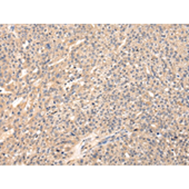 Immunohistochemistry - VIP Antibody from Signalway Antibody (42832) - Antibodies.com